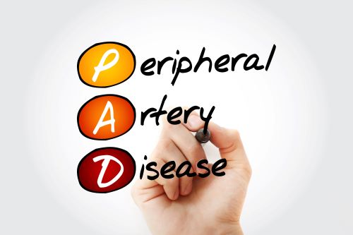Health: Graphic of acronym PAD, which stands for Peripheral Artery Disease