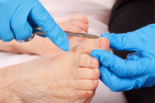 doctor examining foot